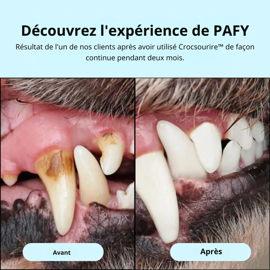 crocsourire - L'Hygiène Dentaire en Un Geste